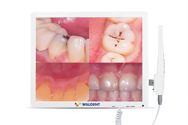 Intra-Oral Camera